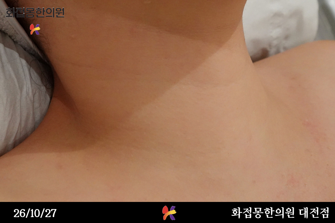 전후사진
