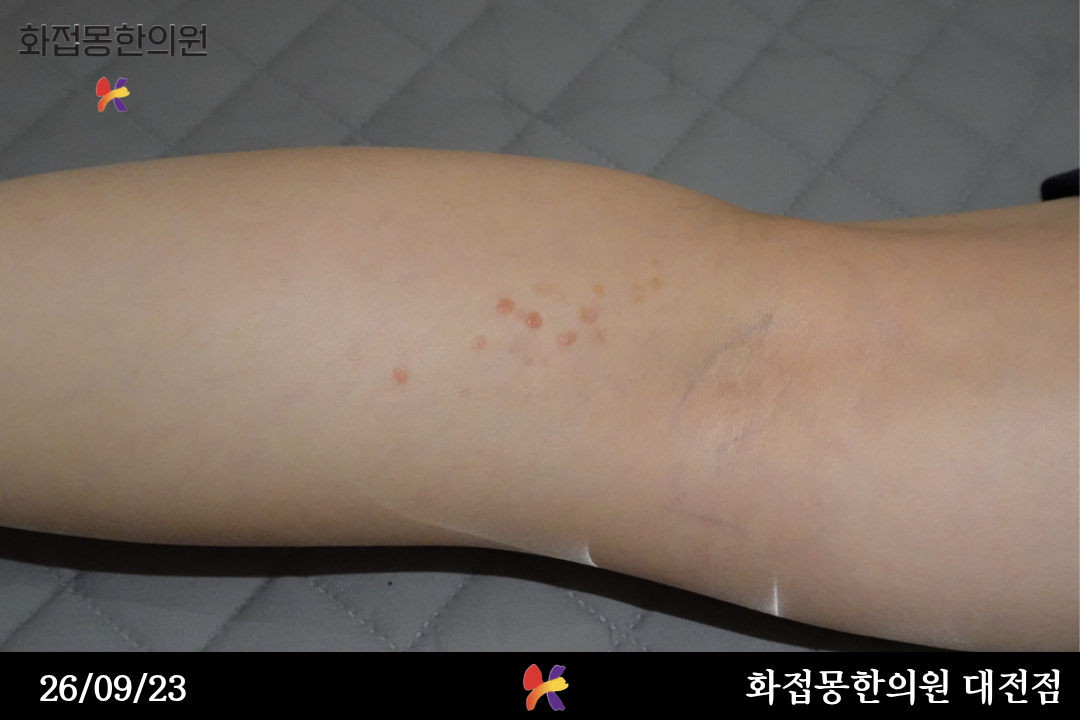 전후사진