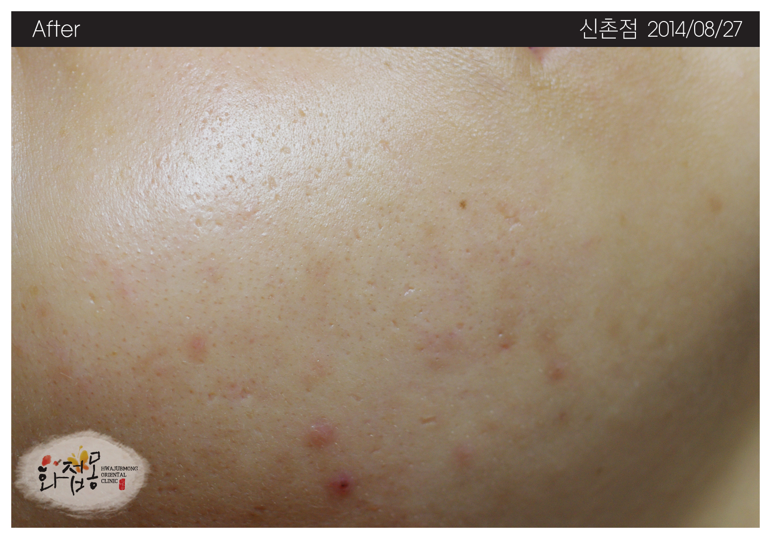 전후사진