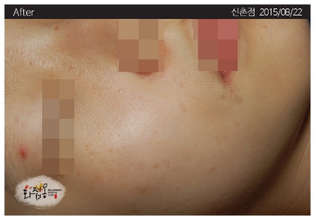 전후사진