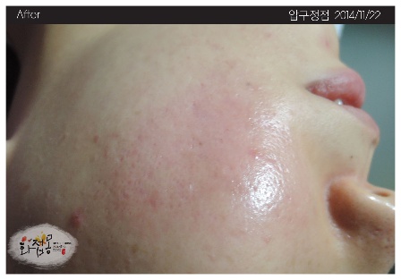 전후사진