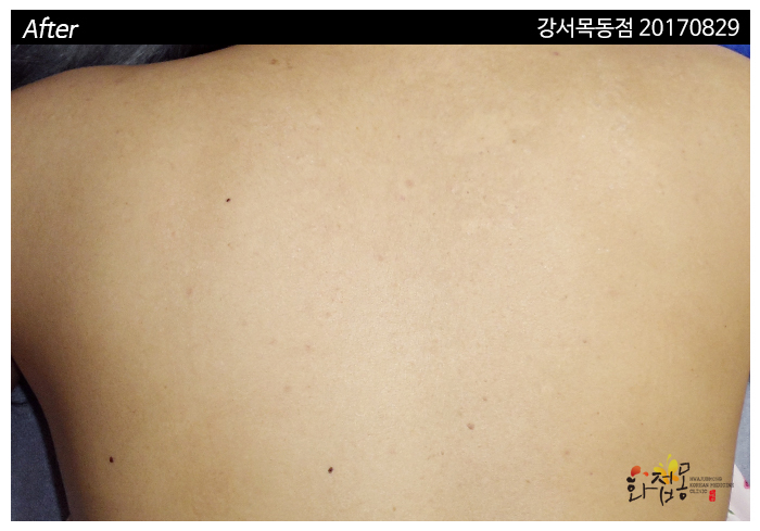 전후사진
