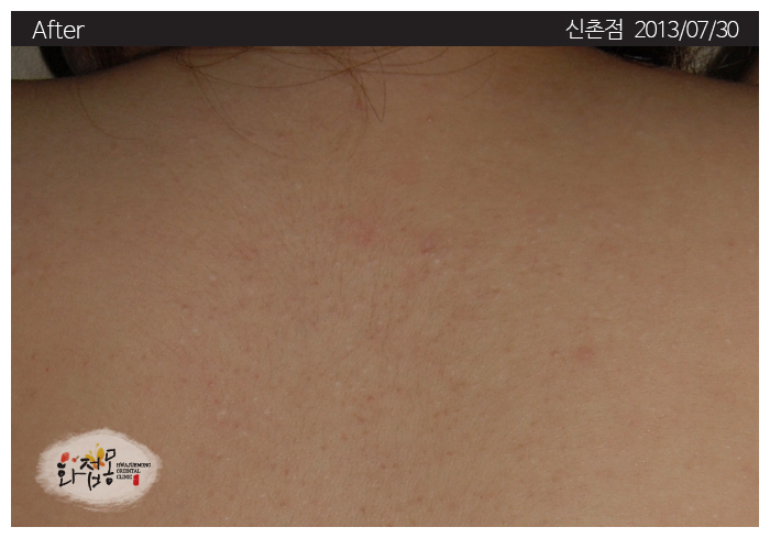 전후사진