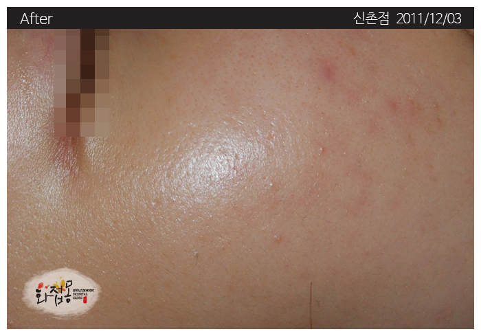 전후사진