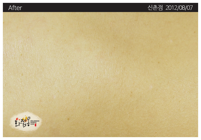 전후사진