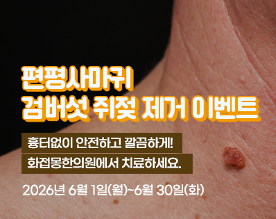 편평사마귀 _39이벤트