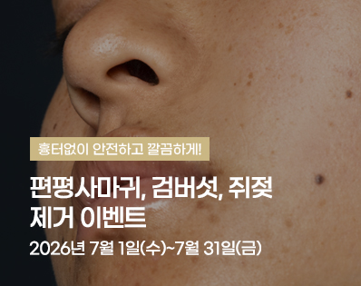 편평사마귀 _39이벤트
