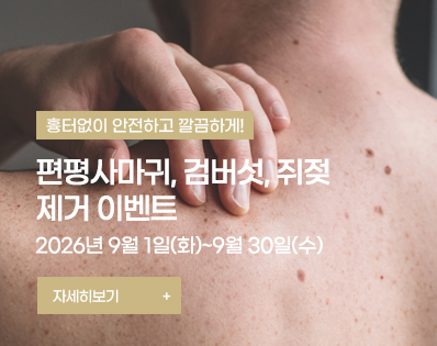 편평사마귀 _39이벤트
