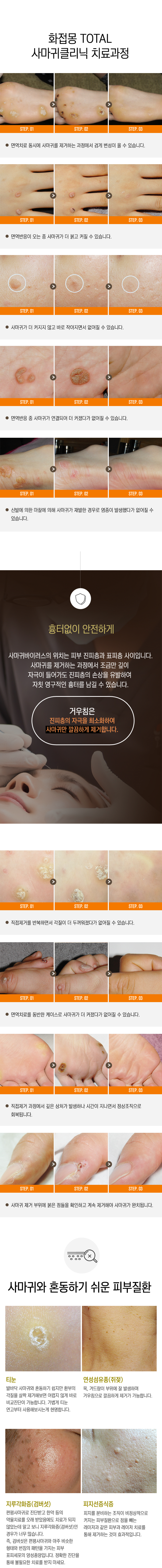 사마귀
